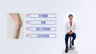 눈에 보이지 않는 잠복성 하지정맥류 확인 사진 18