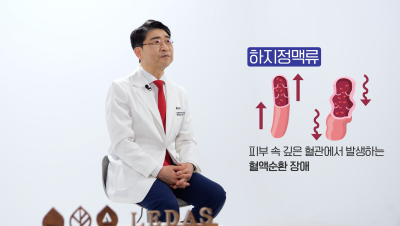 눈에 보이지 않는 잠복성 하지정맥류 확인 사진 4