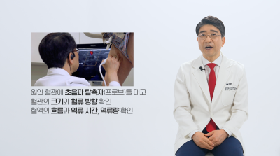 눈에 보이지 않는 잠복성 하지정맥류 확인 사진 14