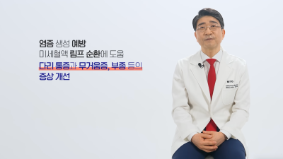 하지정맥류 당장 치료가 어렵다면, 약물? 압박스타킹?