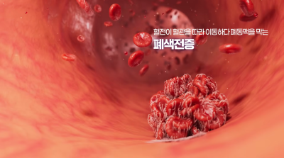 장거리 비행 앞두고 계시다면, 이코노미클래스 증후군(심부정맥혈전증) 조심하세요! 사진 9
