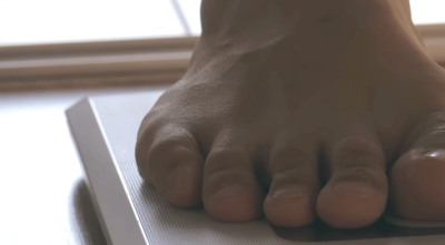 하지정맥류, 비만과 흡연이 위험한 이유 사진 19