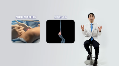 4명 중 1명은 하지정맥류 재발? 재발 원인, 논문을 통해 알려드립니다 사진 5