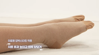 하지정맥류 수술 후 압박스타킹 신는 이유와 착용 기간 사진 9