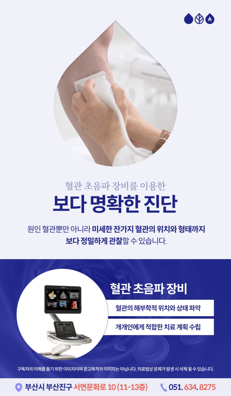 부산하지정맥류 증상 원인, 오래 서 있는 직업이라면 주목! 사진 5