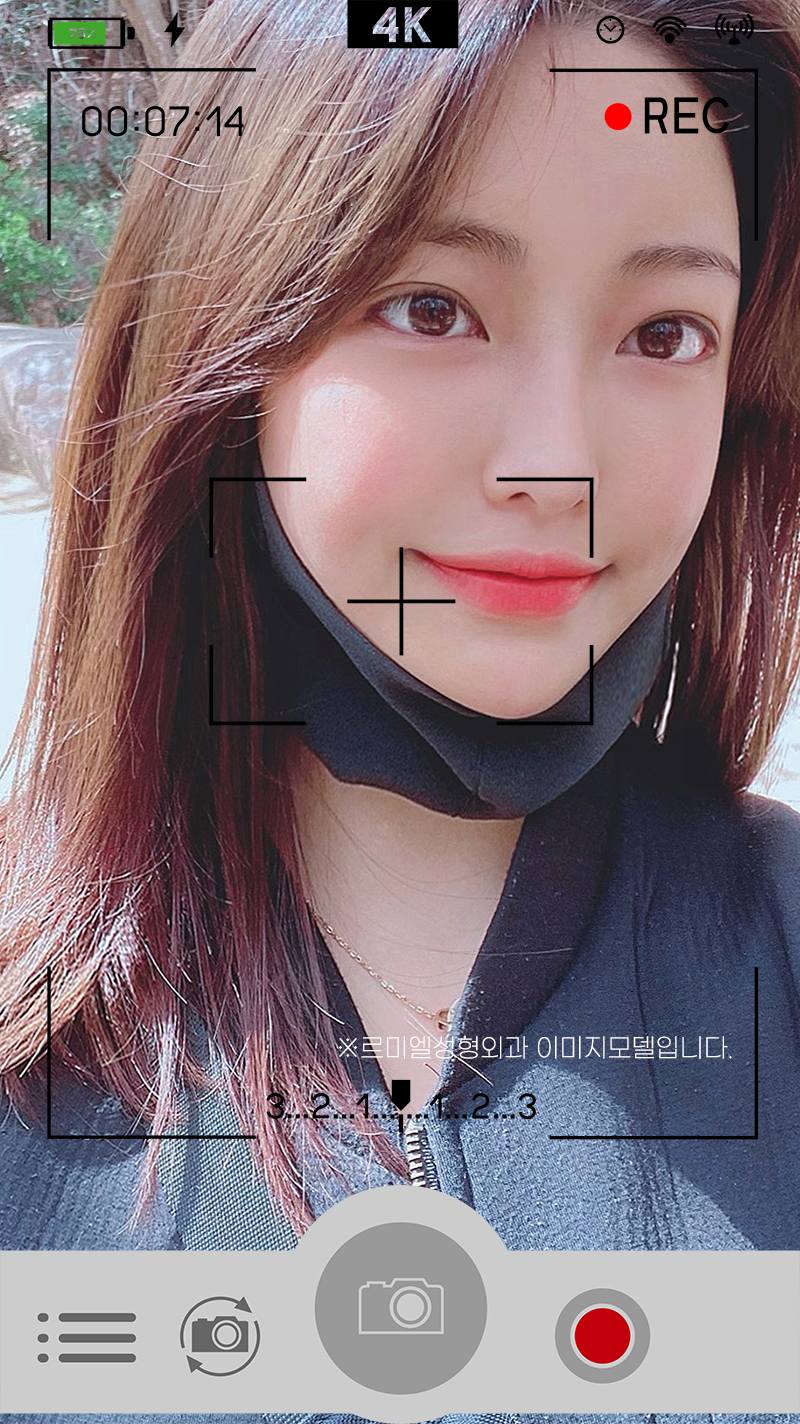 윗트임 해야할까요? 사진 3