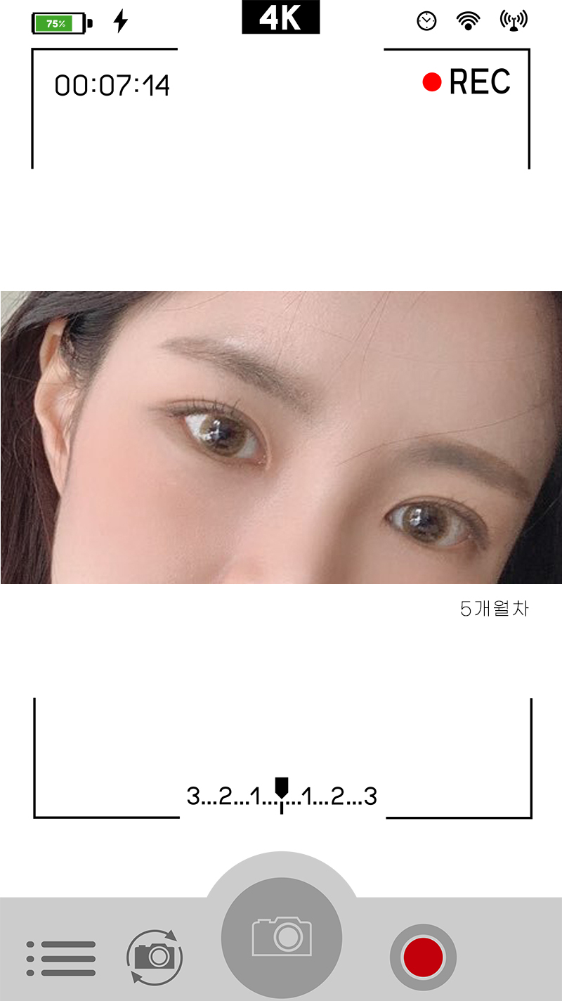 안검하수눈매교정 진가를 알려드립니다 사진 7