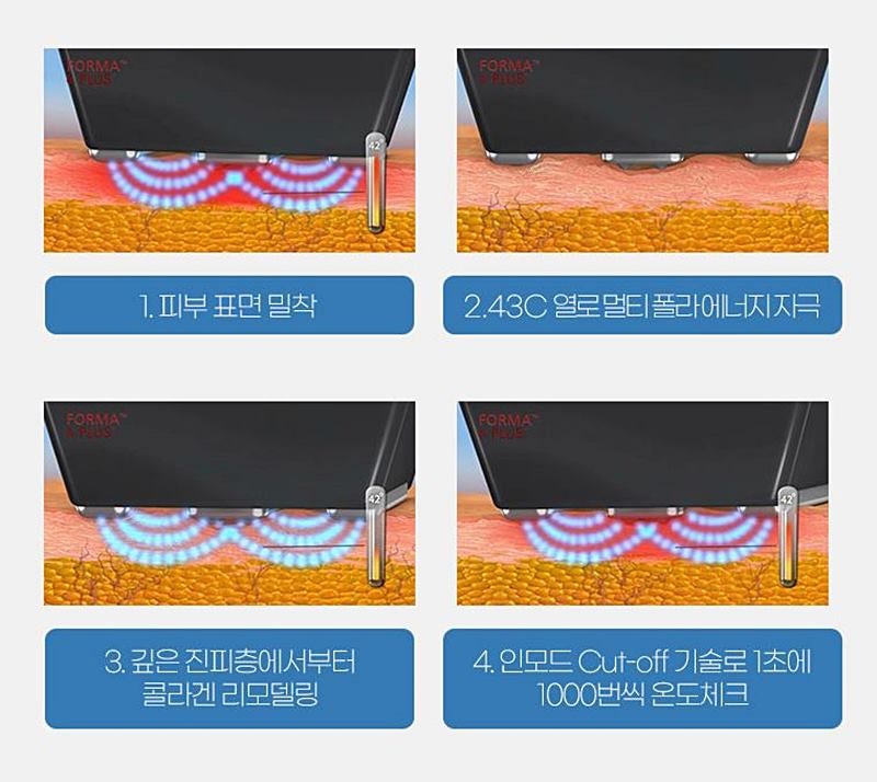 인모드효과 어떻게 좋을까? 사진 5