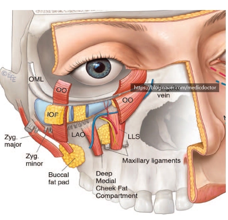 Premaxillary space- 이거를 잘 알아야 눈밑지방 재배치 수술에 도움이 된다.