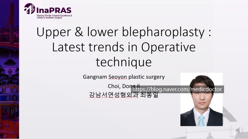 인도네시아 학회 -붓기 적은 자연스러운 상안검 수술 , 애교살 보존 하안검 수술  2021년 6월