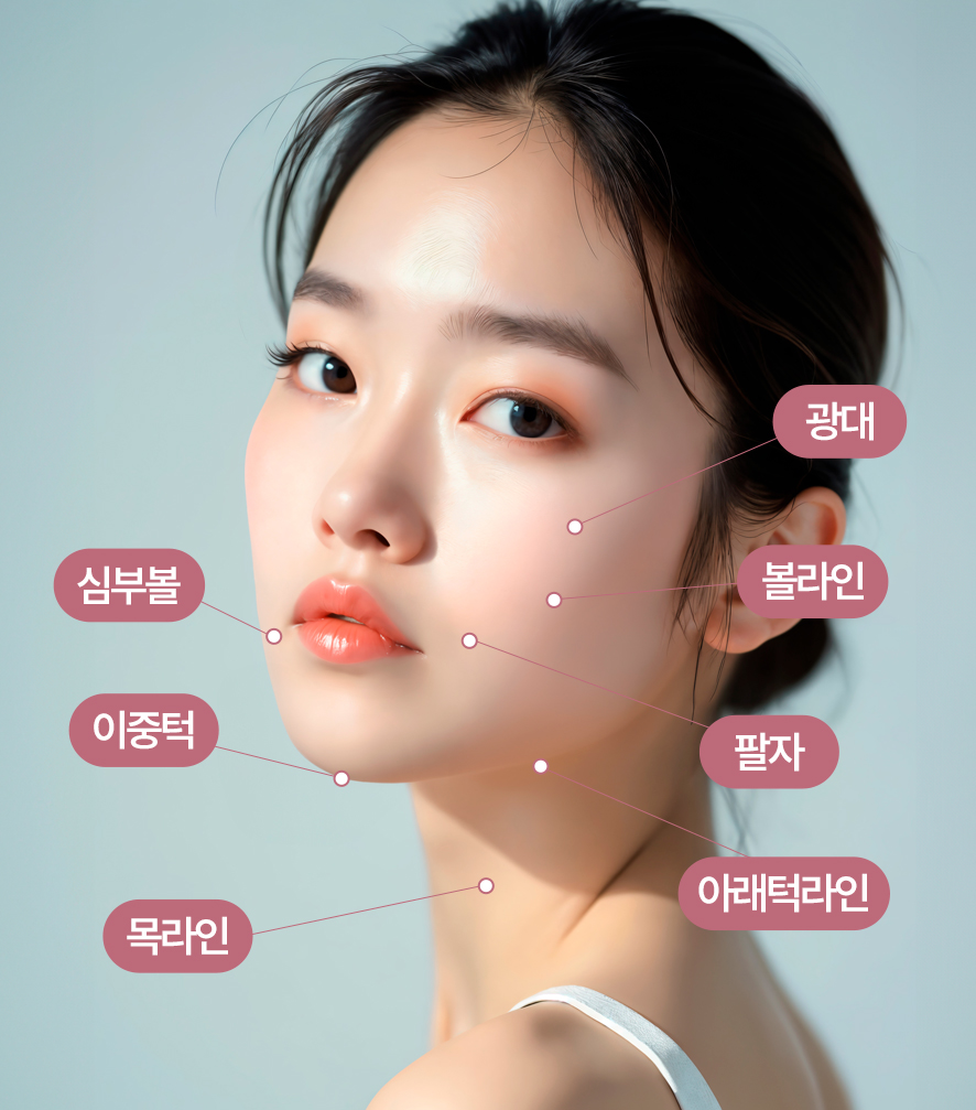 이중턱 지방흡입 50cc 실제사례, 전후사진 비교 사진 11