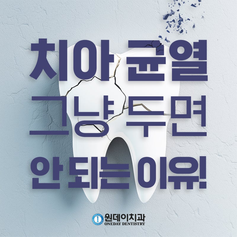 [원데이 치과]치아 균열, 그냥두면 안되는 이유!