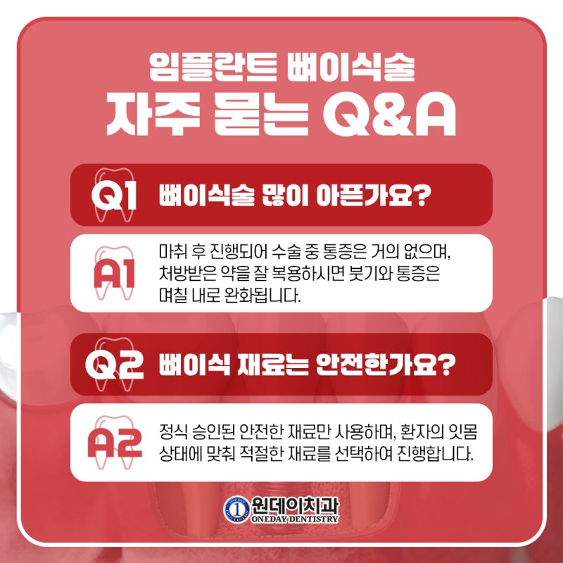 [원데이 치과]임플란트 뼈이식, 꼭 해야할까? 사진 5