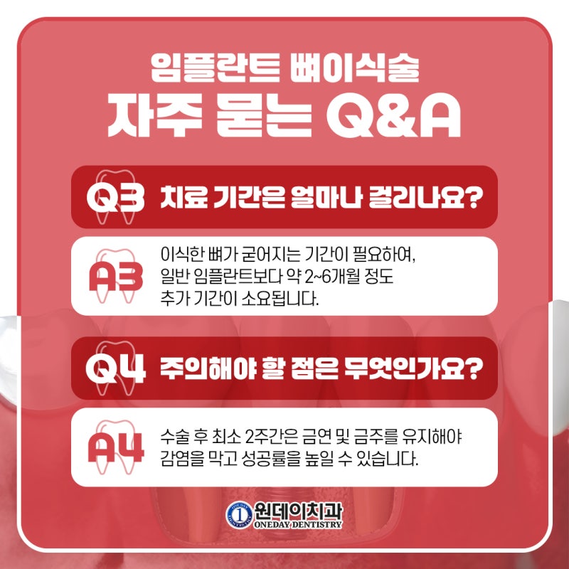[원데이 치과]임플란트 뼈이식, 꼭 해야할까? 사진 6