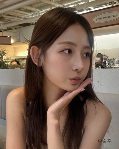 코성형 하나로 달라진 이미지 매부리코 직반코성형 전후 사진 5