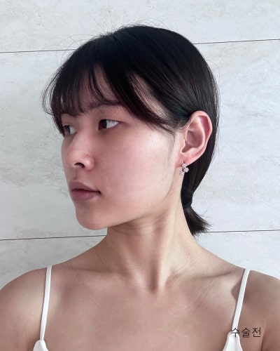 풀린눈재수술, 이마거상, 코성형 전후 사진 8
