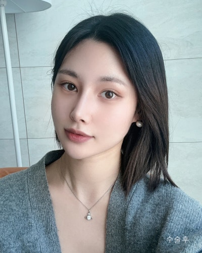 풀린눈재수술, 이마거상, 코성형 전후 사진 7