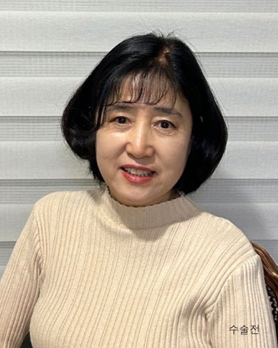 중년성형 안면거상,이마거상,눈매교정,하안검 전후 사진 10