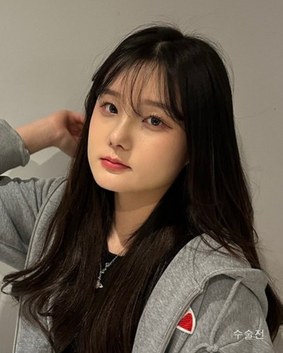 사각턱원인과 수술방법 윤곽3종 전후 사진 4