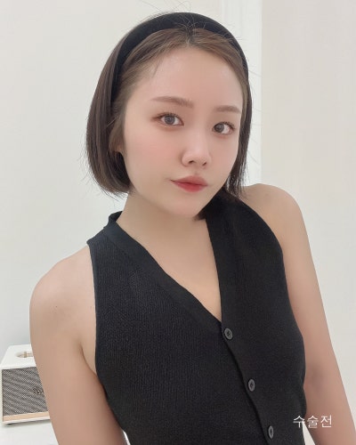 다이어트 후 사라진 가슴 멘토부스트 가슴성형 전후 사진 2