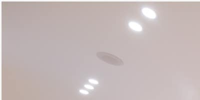 부산 연산동 귀필러 요정귀 시술 인기인 이유는? 사진 12