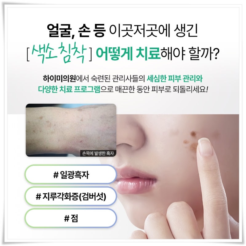 연산역검버섯 단순한 잡티로 넘기지 말아야 하는 이유 사진 2