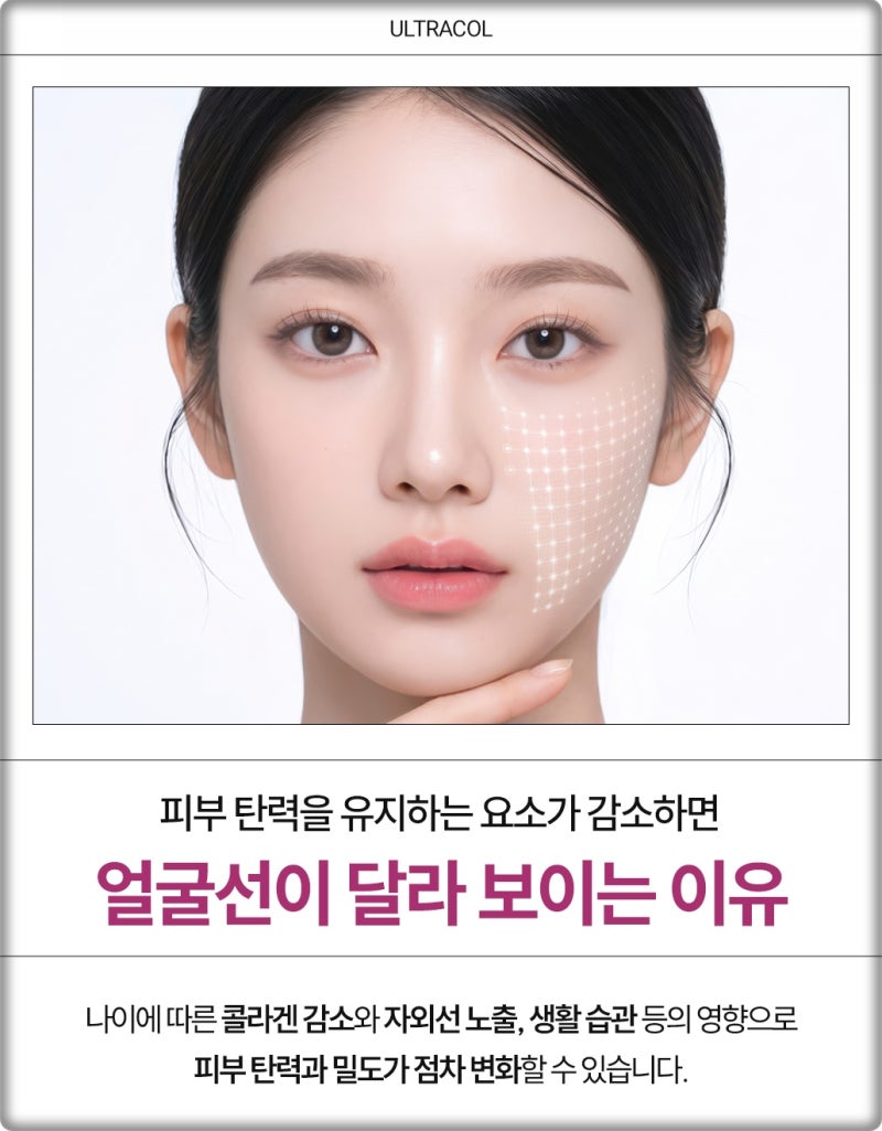 연산동울트라콜 자연스러운 볼륨과 피부 탄력을 함께 고려한다면 사진 3