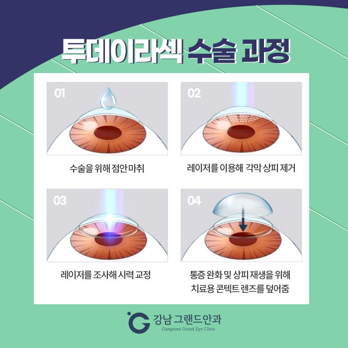 강남 투데이라섹(2day라섹) 고민이라면! 사진 4