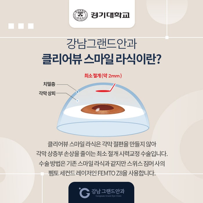 경기대학교 시력교정 제휴 혜택 안내 사진 3