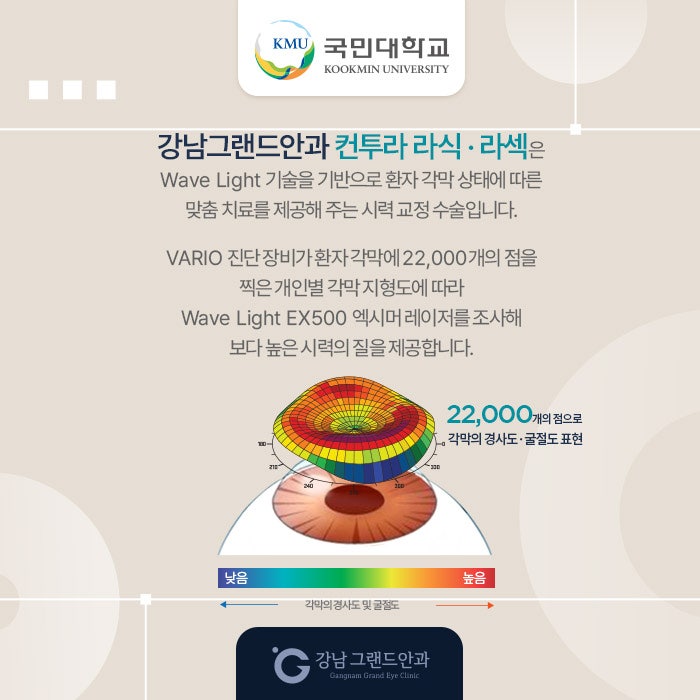 국민대학교 시력교정 제휴 혜택 안내 사진 6