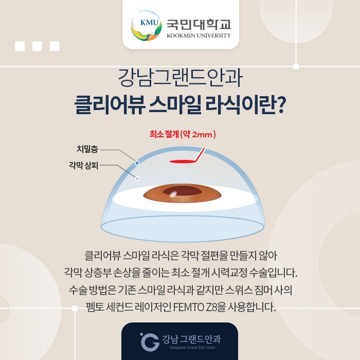 국민대학교 시력교정 제휴 혜택 안내 사진 3