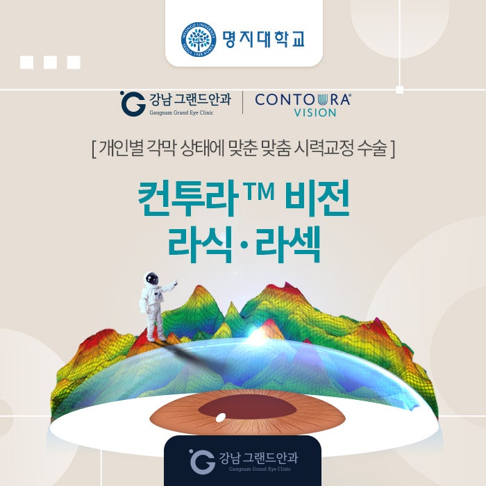 명지대학교 시력교정 제휴 혜택 안내 사진 5