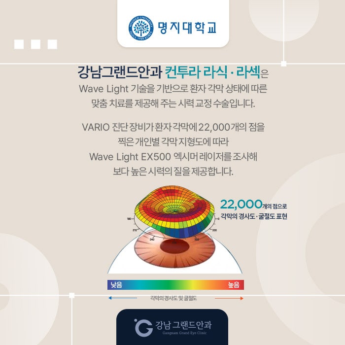 명지대학교 시력교정 제휴 혜택 안내 사진 6