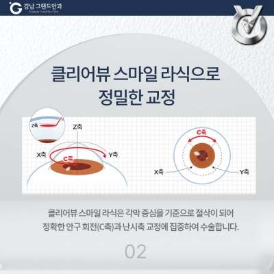강남 라식 상담 병원 찾으신다면? 사진 4