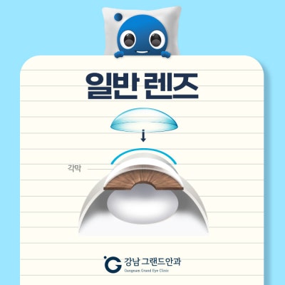 강남역 드림렌즈 안과 초등학생 근시교정 부작용 알아보자! 사진 2