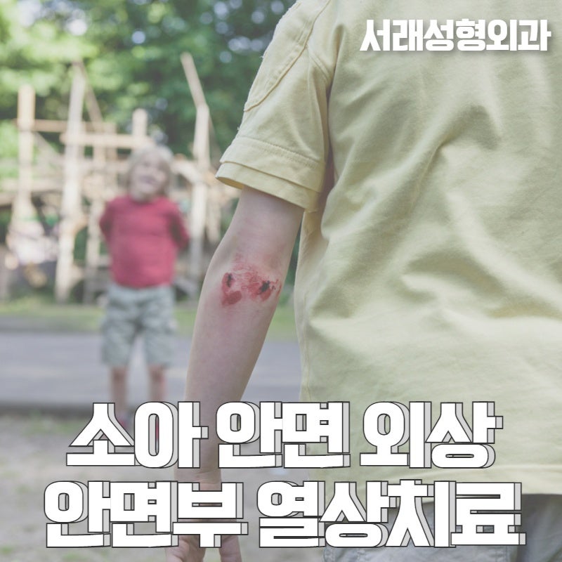 소중한 우리 아이, 소아 외상치료 서래성형외과에서 흉터고민까지 해결해 드려요