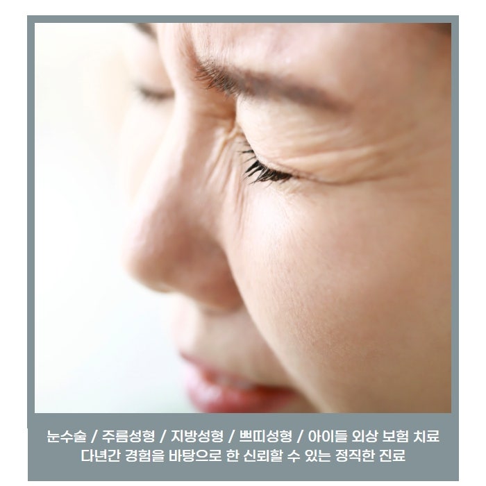 주름성형의 마무리! 매끈하게 주름 없이 개선 내시경 안면거상술