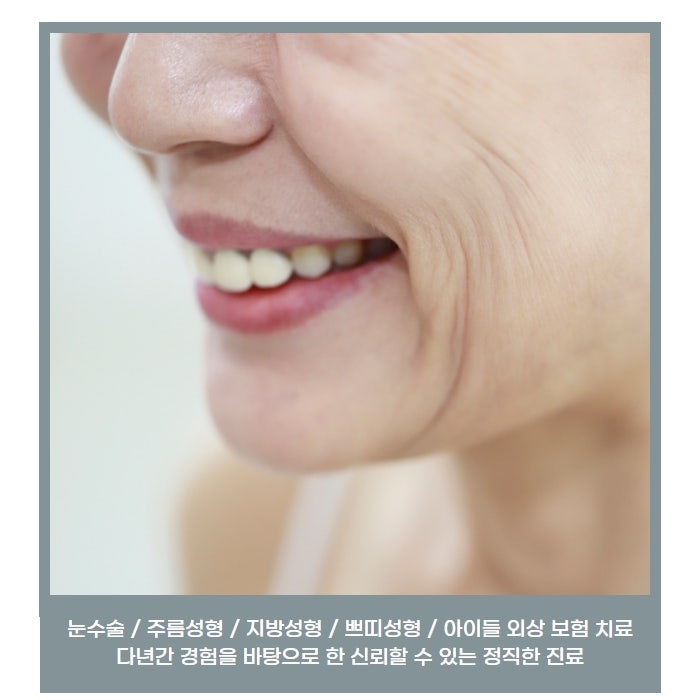주름성형의 마무리! 매끈하게 주름 없이 개선 내시경 안면거상술 사진 4