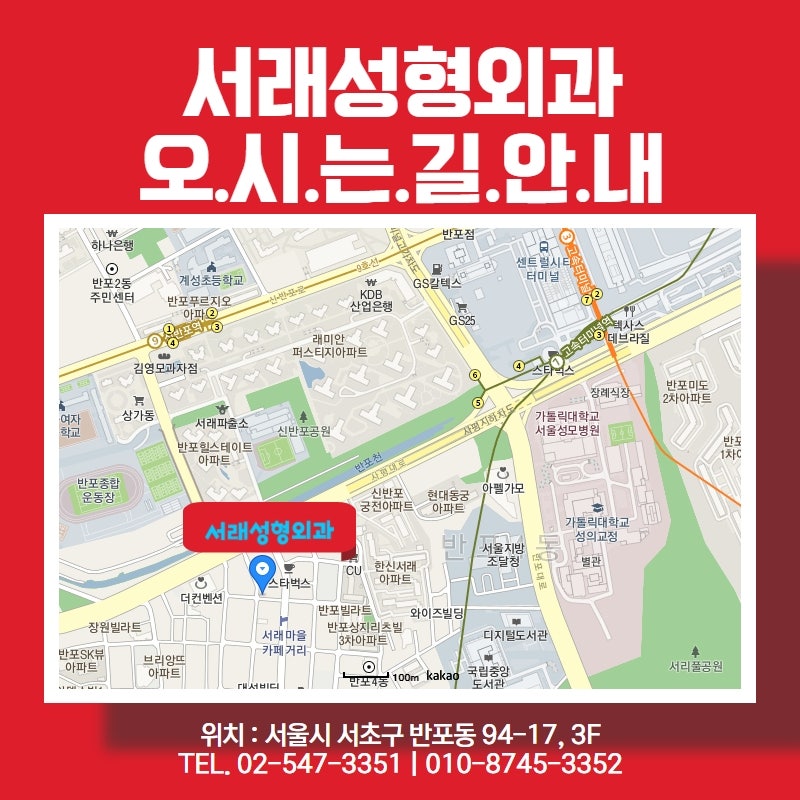 서래성형외과, 동안 성형을 선택하실 때 노화 진행 상태까지 체크해야 하는 눈성형 사진 6