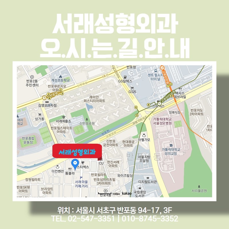 이마주름과 함께 쌍꺼풀 없이 눈매교정도? 내시경이마거상술비용 서래성형외과 사진 3