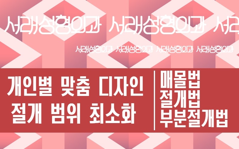 풀릴 걱정없는 자연스러운 눈성형, 맞춤형 눈성형 서래성형외과 사진 3