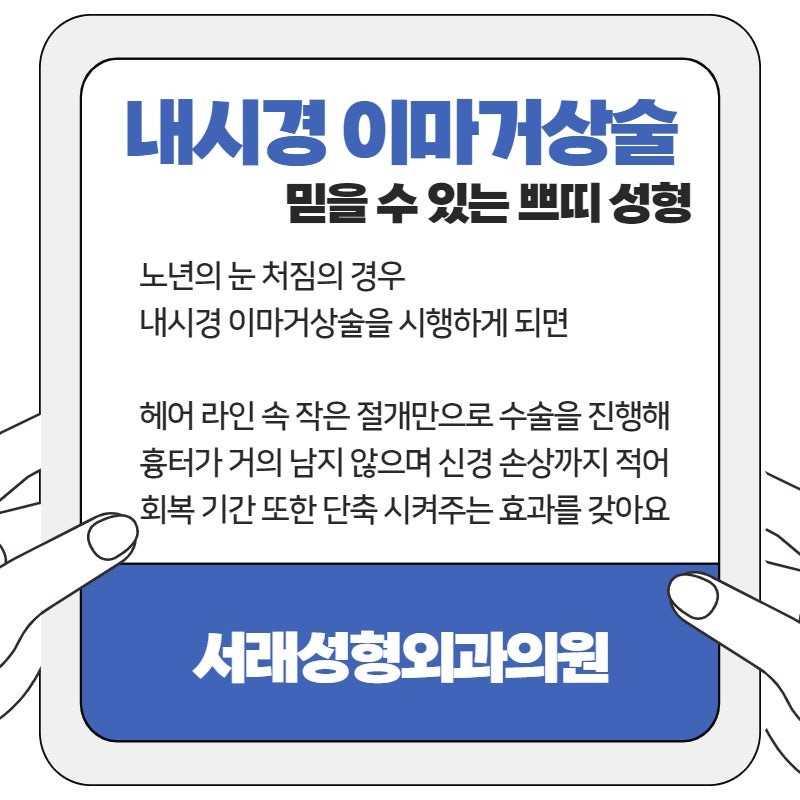 중년이 되면서 처지는 눈, 내시경 이마거상술 이해하고 선택해요 사진 3