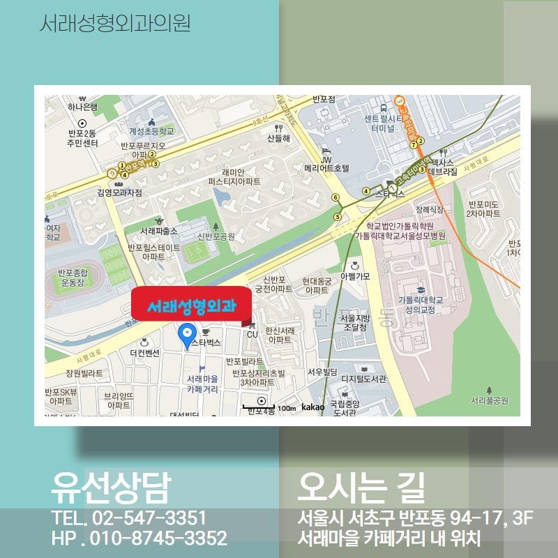 흉터를 최소화 한 내시경 이마거상술, 이마주름과 눈처짐 한번에 개선 사진 6