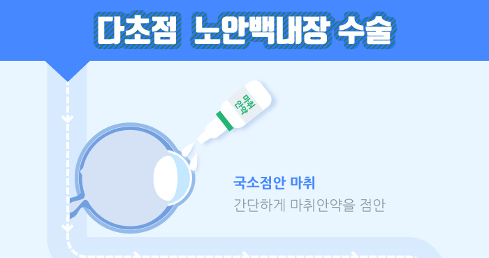 การผ่าตัดต้อกระจกและสายตายาวตามวัยแบบหลายจุดโฟกัสคืออะไร? / Smile Eye Clinic Gangnam, แนะนำคลินิกตาคังนัม