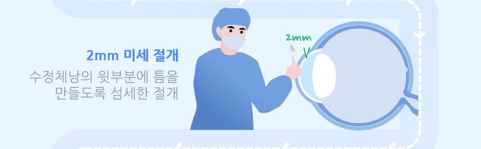 多焦点老花眼白内障手术是什么?/江南Smile眼科,江南眼科推荐 사진 4