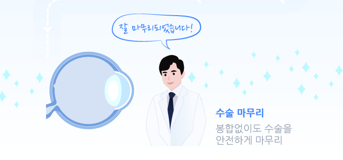 多焦点老花眼白内障手术是什么?/江南Smile眼科,江南眼科推荐 사진 7