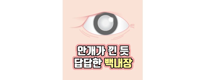 [ต้อกระจก] สาเหตุของต้อกระจกที่ทำให้ตามัวคืออะไร?!