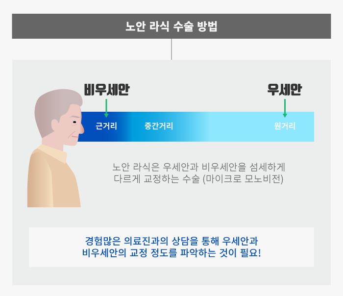 [노안] 굴절이상과 노안을 한 번에! 노안 라식의 원리 / 강남 안과추천 사진 3