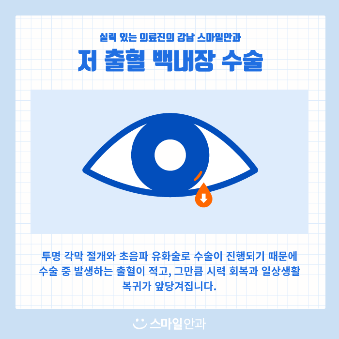 [노안/백내장] 이미 진행된 백내장, 한 번의 수술로 맑은 시야를 되찾아보세요! 사진 3