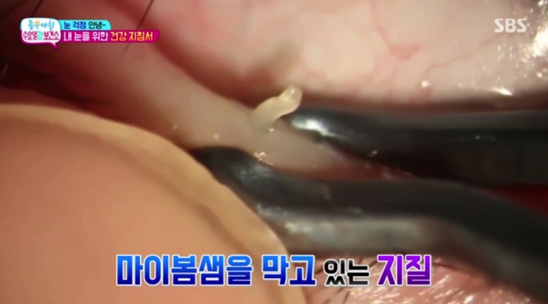 SBS صباح الخير 'الأربعاء في المركز الصحي' فيديو قناة Smile Doctor Yeom Sabu TV متاح الآن! 사진 4